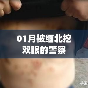 緬北警察遭遇暴力襲擊，雙眼被挖事件回顧