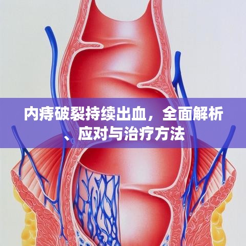 內(nèi)痔破裂持續(xù)出血，全面解析、應(yīng)對(duì)與治療方法