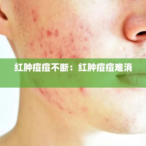 紅腫痘痘不斷：紅腫痘痘難消 