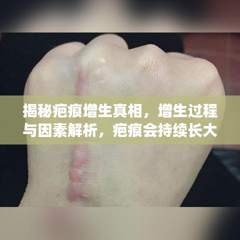 揭秘疤痕增生真相，增生過程與因素解析，疤痕會持續(xù)長大嗎？