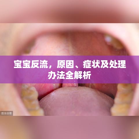 寶寶反流，原因、癥狀及處理辦法全解析