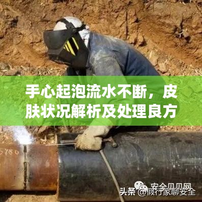 手心起泡流水不斷，皮膚狀況解析及處理良方