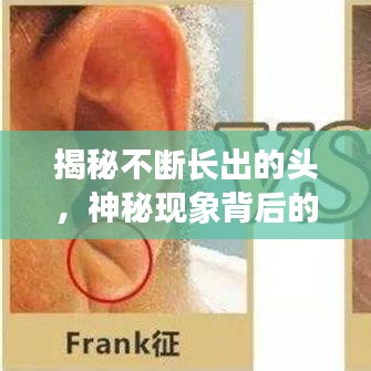 揭秘不斷長出的頭，神秘現(xiàn)象背后的醫(yī)學(xué)探索之旅