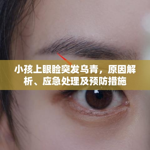 小孩上眼瞼突發(fā)烏青，原因解析、應(yīng)急處理及預(yù)防措施