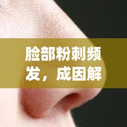 臉部粉刺頻發(fā)，成因解析與防治管理策略